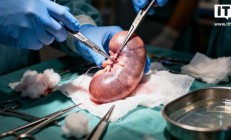 异种移植迎突破：美国启动人体移植基因编辑猪肾规模化临床试验